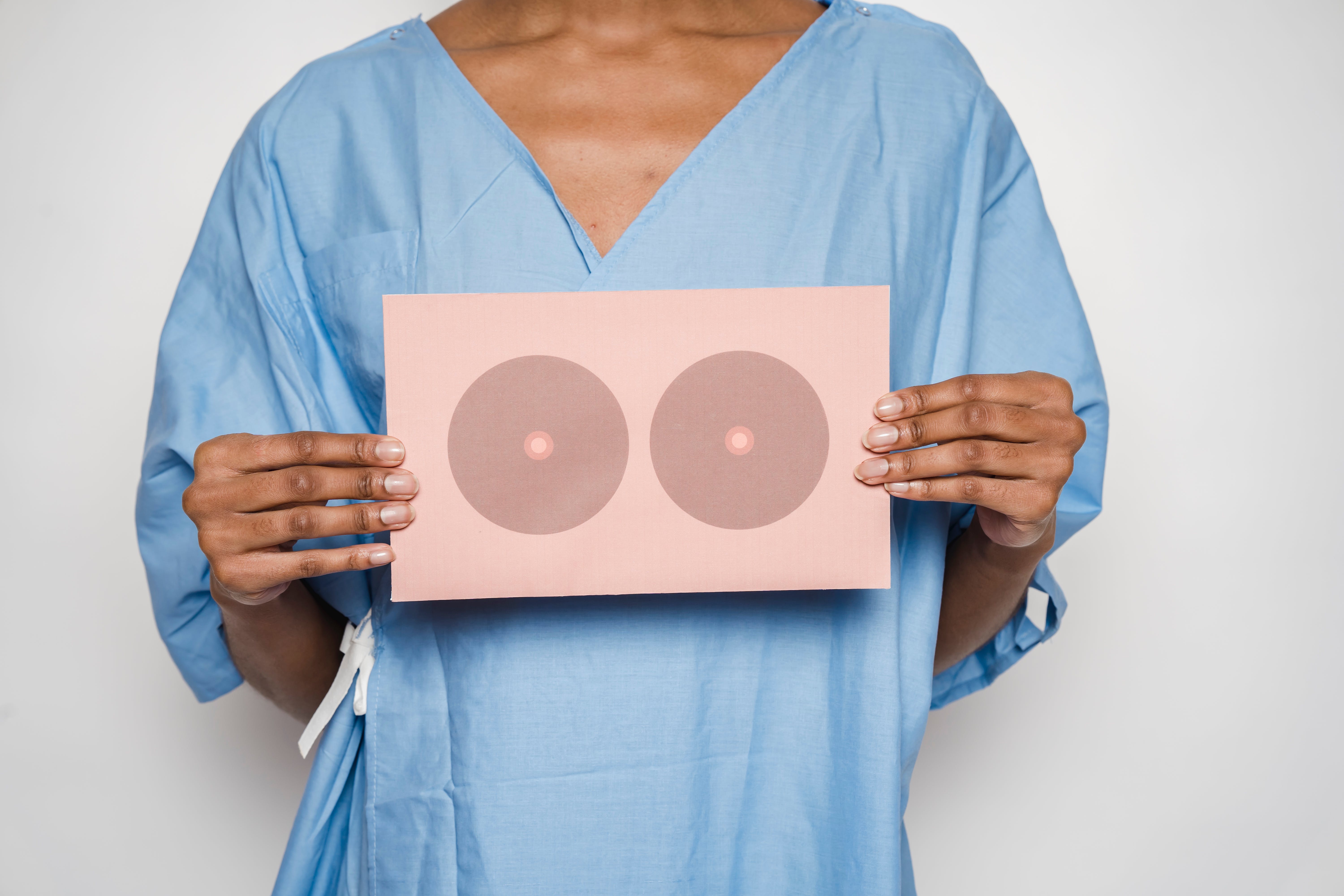 Is My Treatment for Breast Cancer Aging Me?